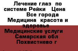 Лечение глаз  по системе Рейки › Цена ­ 300 - Все города Медицина, красота и здоровье » Медицинские услуги   . Самарская обл.,Похвистнево г.